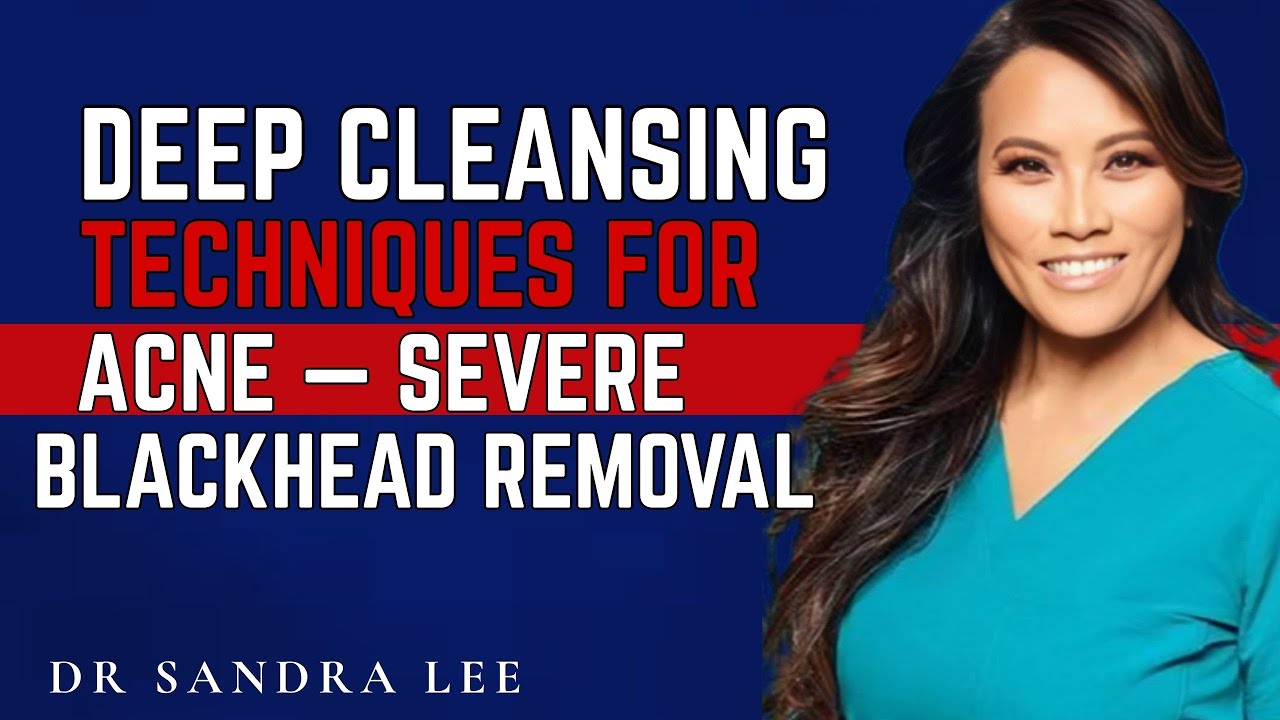 Deep Cleansing Techniques For Acne &mdash; Severe Blackhead Removal.[ DR SANDRA LEE]