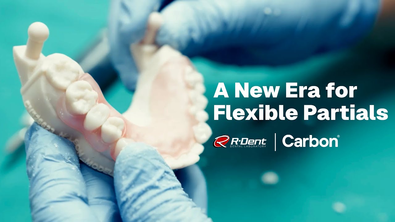 A New Era for Flexible Partials at R-Dent with FP3D