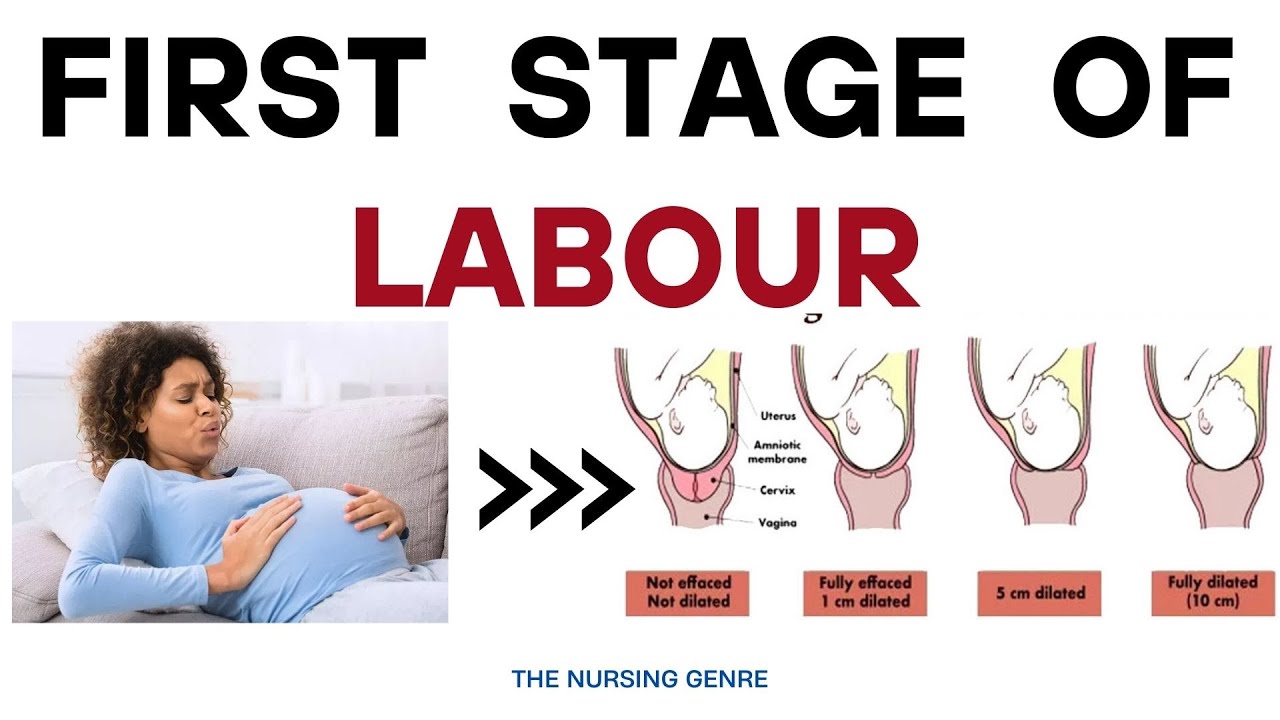 FIRST STAGE OF LABOUR | OBG | Uterine & Maternal factors | clinical features | Management