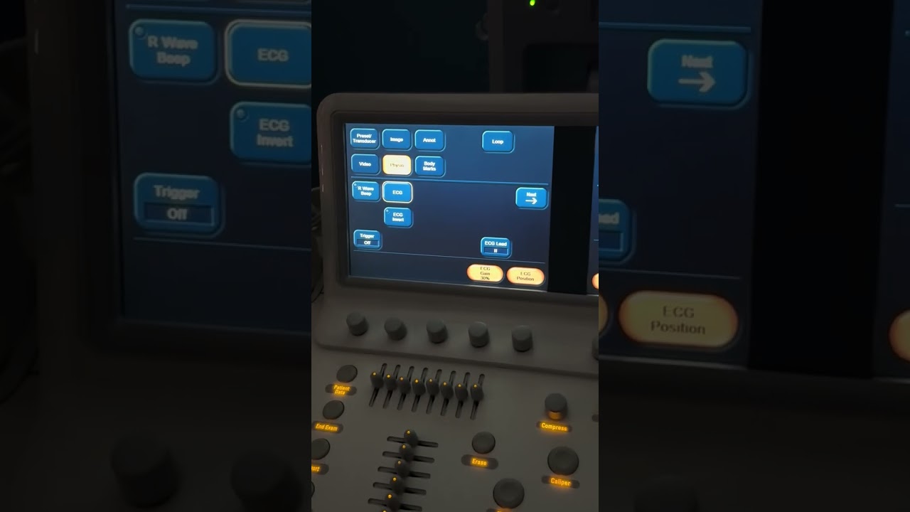 Philips IE33 Ultrasound Machine Basic User Guide