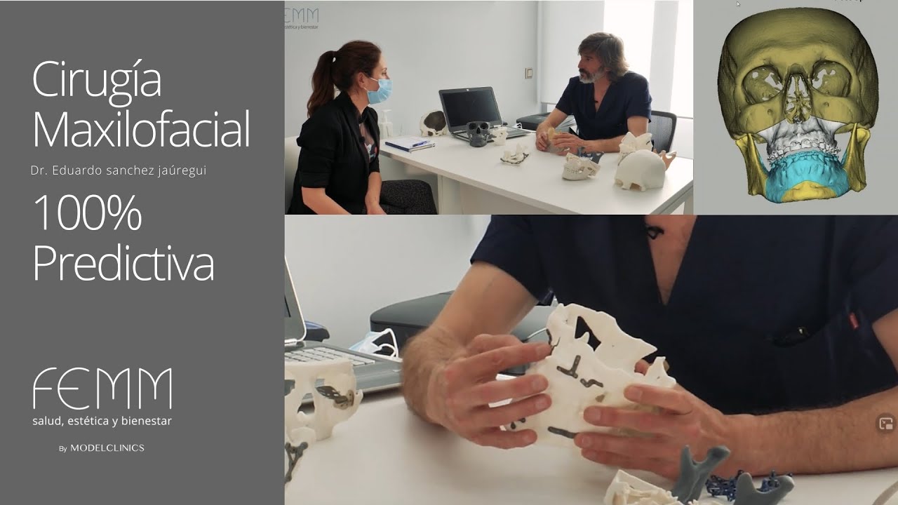 Cirugía Maxilofacial. Resultados 100% predictivos.