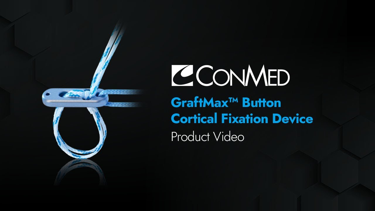 GraftMax&trade; Button Adjustable Cortical Fixation Device - CONMED Product Video