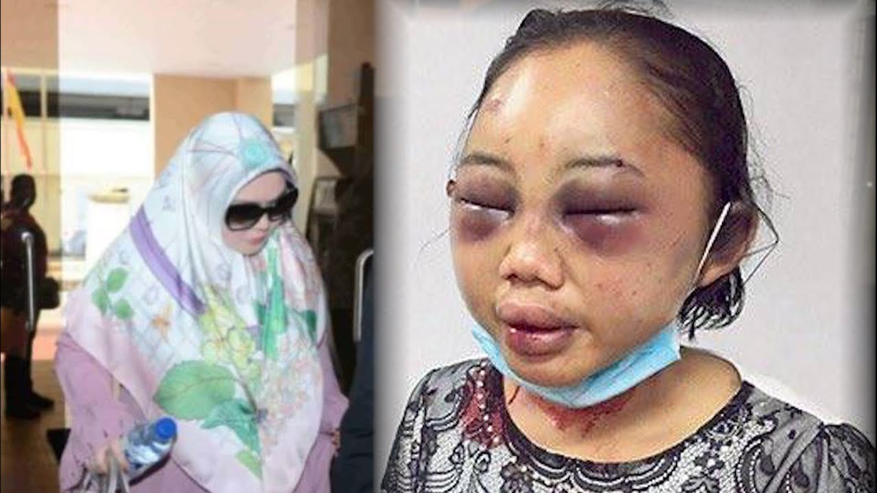 AG urged to appeal against lenient sentence for ‘Datin’ who severely injured her maid
