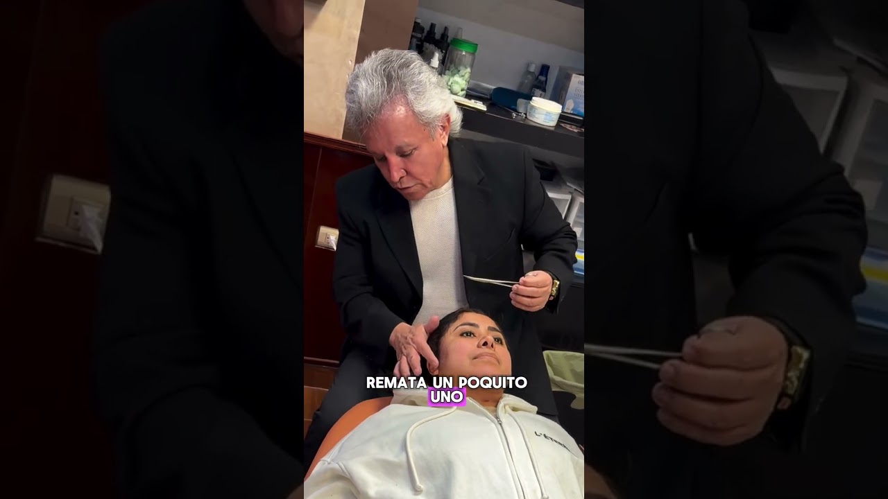 Los Resultados de mi Lipopapada 🤯🤯