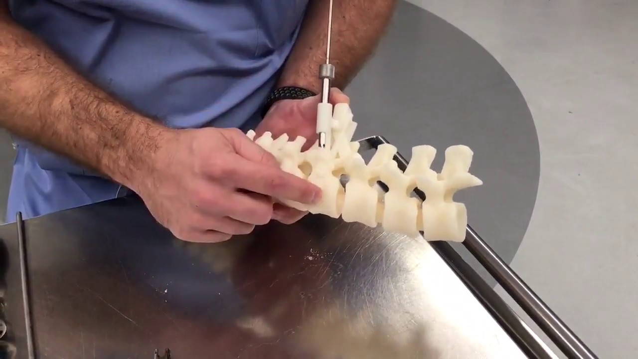 Scoliosis Surgery Demo | WKAR News | NPR