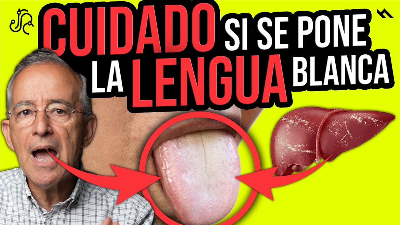 TIENES LA LENGUA BLANCA POR ESTO Cuidado Mira Este Video - Oswaldo Restrepo RSC