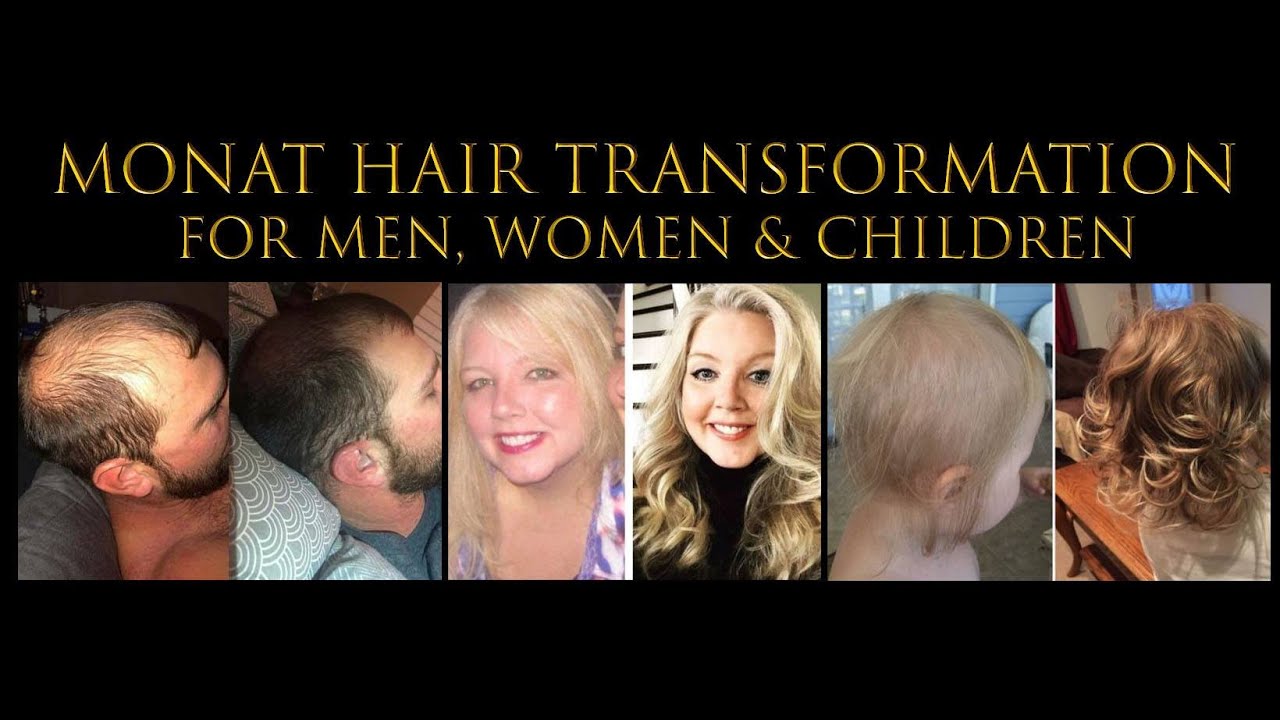 Monat Results Before After, Nontoxic Healthy, Grow Hair Fast. Fix Hair Loss, Alopecia, Postpartum