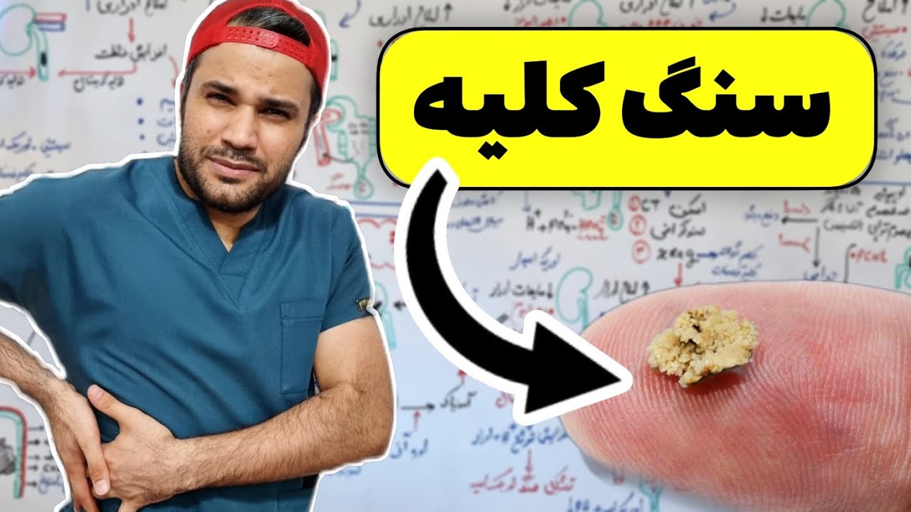سنگ کلیه | انواع | علت |علایم | درمان | nephrolithiasis