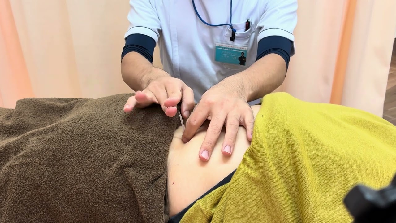 80代女性　腰痛で来院　鍼施術してみた|【宝塚市】おかだ鍼灸整骨院