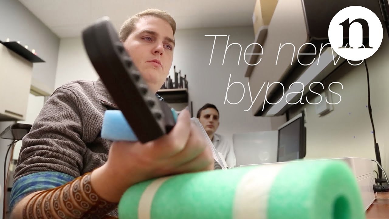 The nerve bypass: how to move a paralysed hand