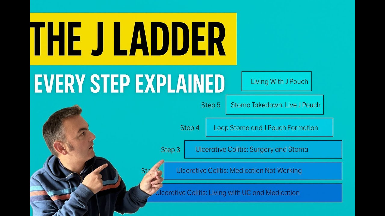The J-Pouch Ladder | Every Step Explained