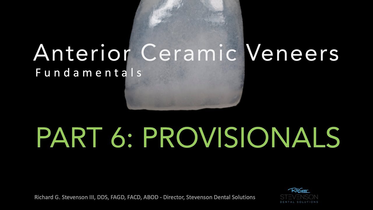 Anterior Ceramic Veneers, Part 6: Provisionals