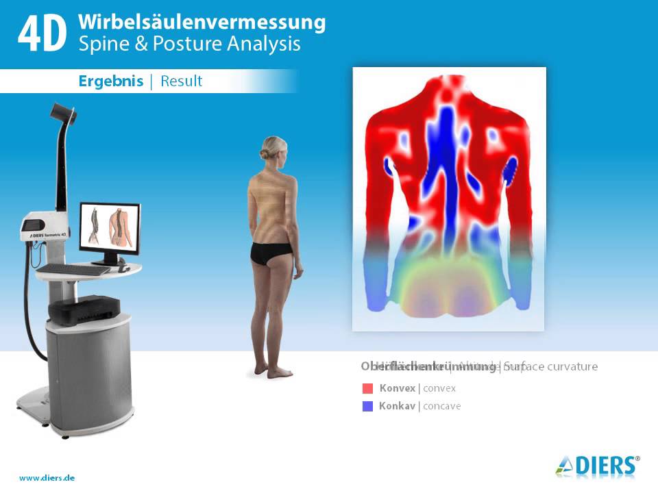 DIERS formetric 4D - (Slide show)