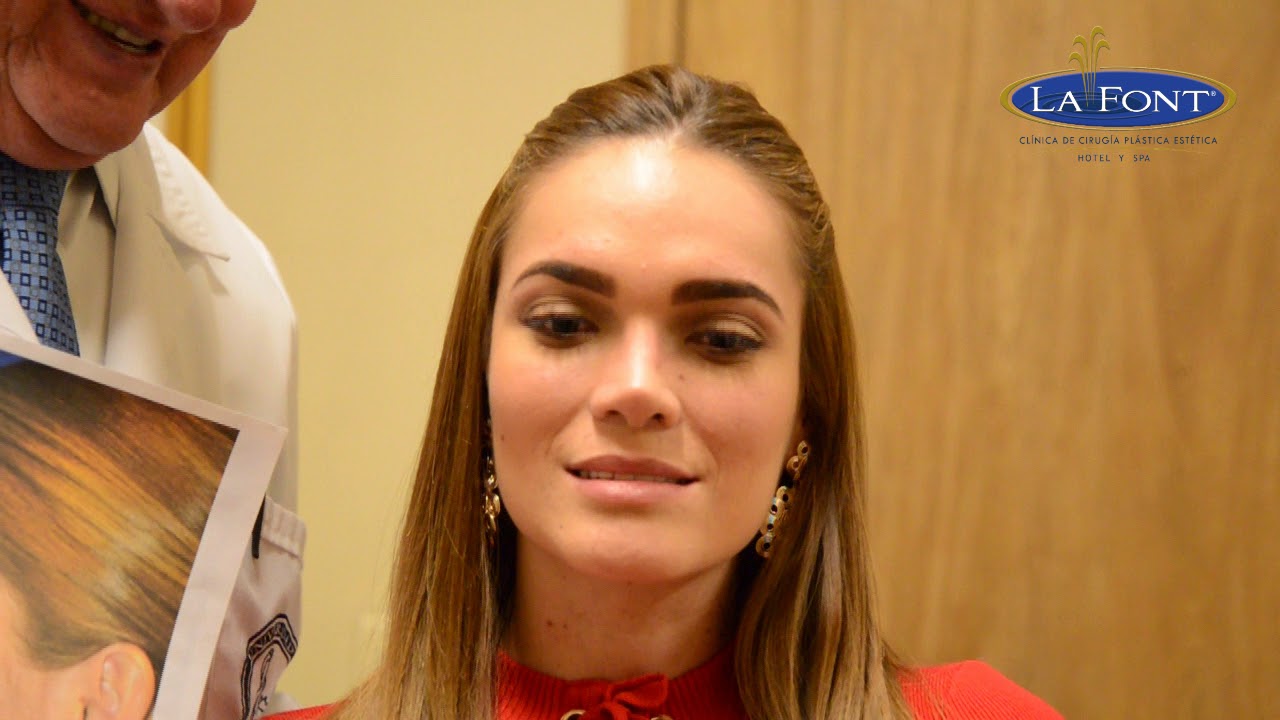 RINOPLASTIA PRIMARIA - BOGOTA, COLOMBIA. DR FERNANDO PEDROZA