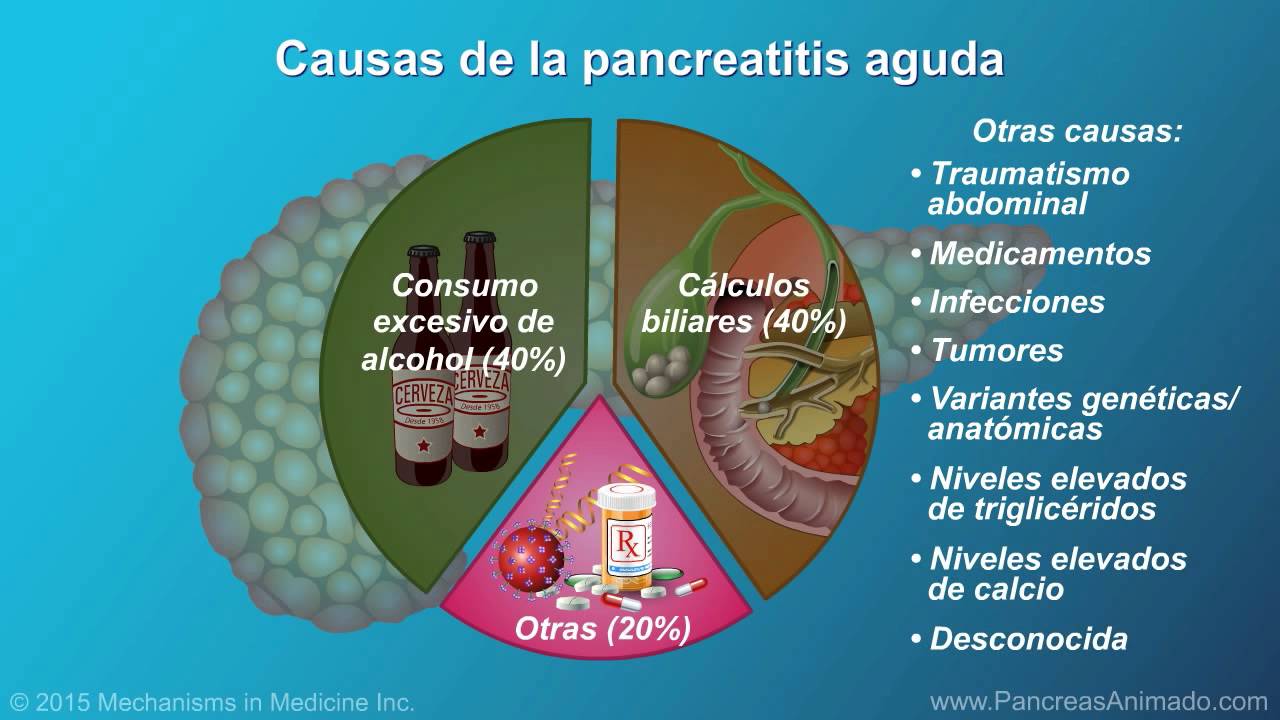 Pancreatitis aguda