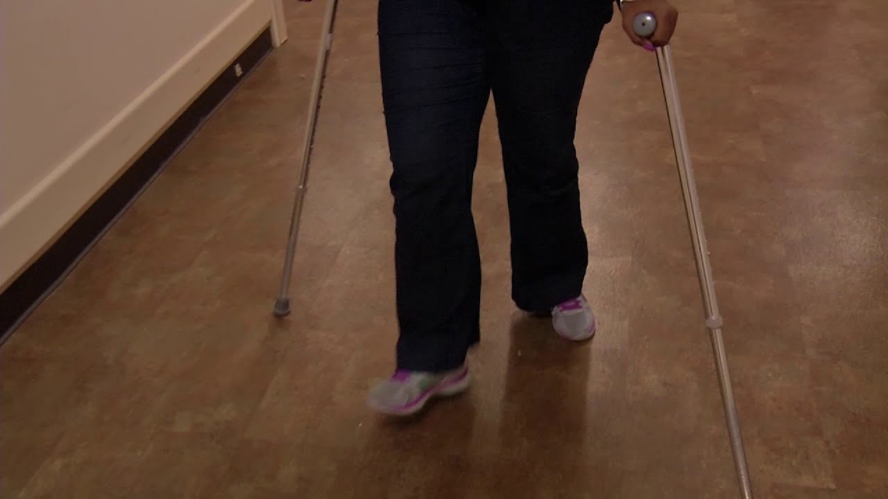 Even doctors miss early signs of multiple sclerosis