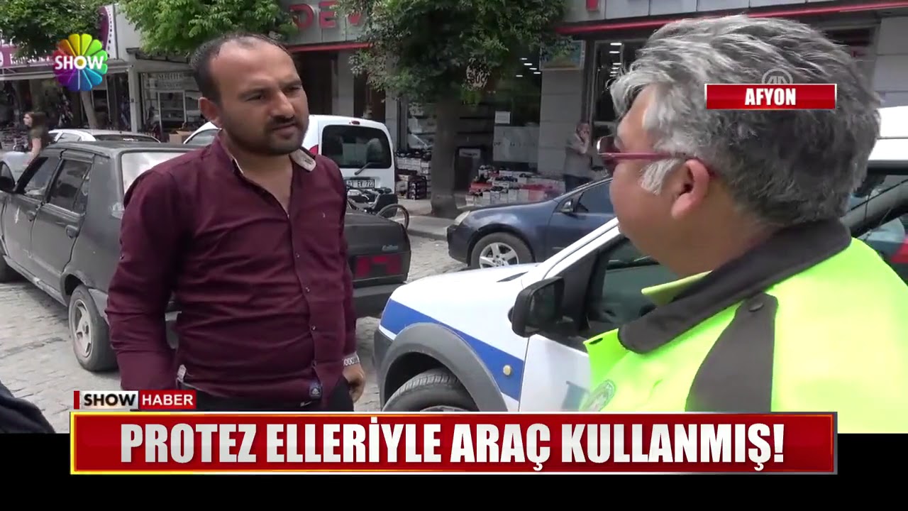 Protez elleriyle araç kullanmış!