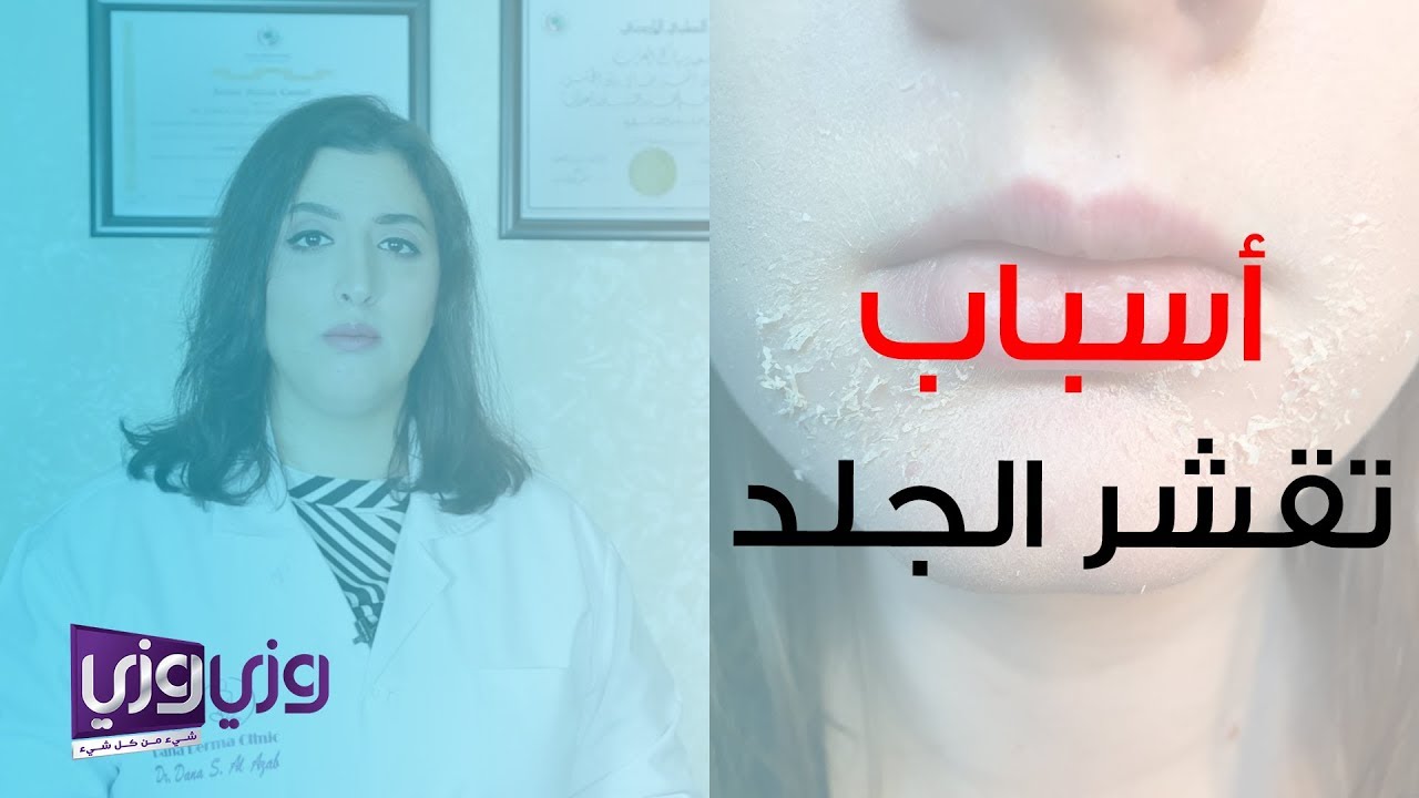 أسباب تقشر الجلد