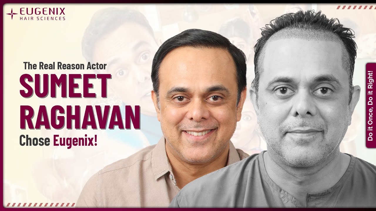 Sarabhai vs Sarabhai Star Sumeet Raghavan Opens Up About His Hair Transplant at Eugenix