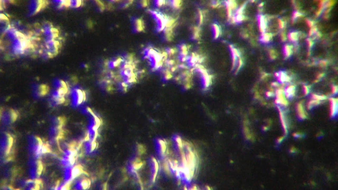 Lyme Disease Australia - Abx Injection - Spirochete Bacteria