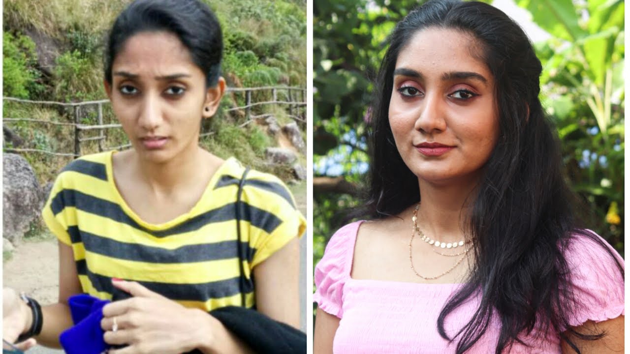 എൻ്റെ Weight Gain Journey || My Transition Video || Abhina Anil