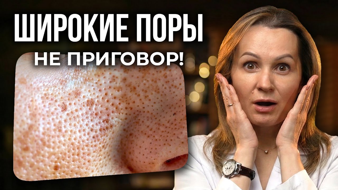 Как УМЕНЬШИТЬ ПОРЫ на лице? Советы косметолога по уходу за кожей с расширенными порами
