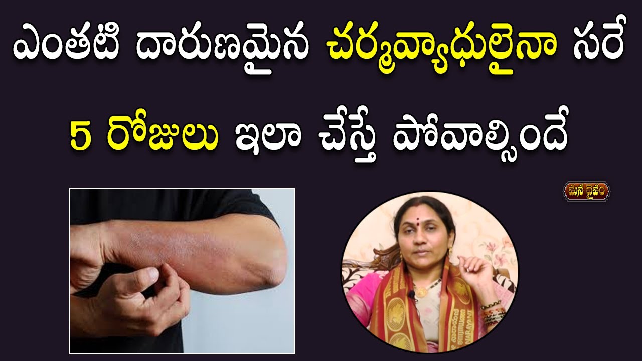 5 రోజుల్లో మీకున్న చ‌ర్మ‌వ్యాధులు దూరం చేసుకోండి ఇలా | Skin Problems Remedy | Nittala Kiranmayi