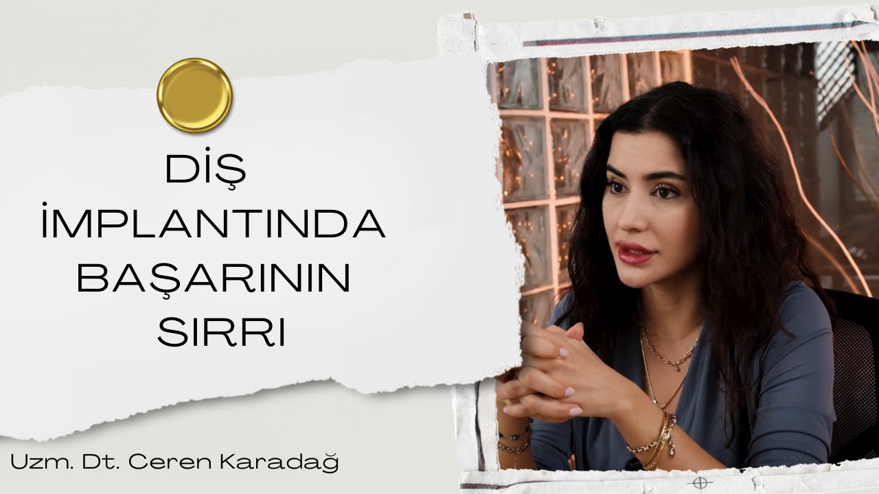 Diş İmplant Tedavisinde Başarı Nasıl Sağlanır? I İmplant Tedavisi Olmadan İzleyin