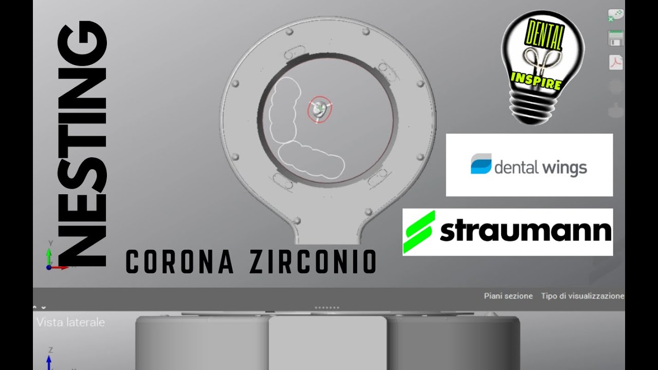 DENTAL WINGS: FASE DI NESTING, FRESATURA ELEMENTO ZIRCONIO
