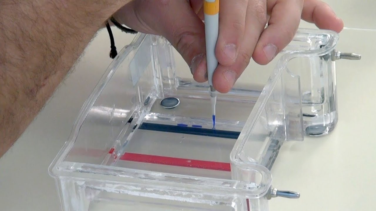 DNA Restriction Analysis