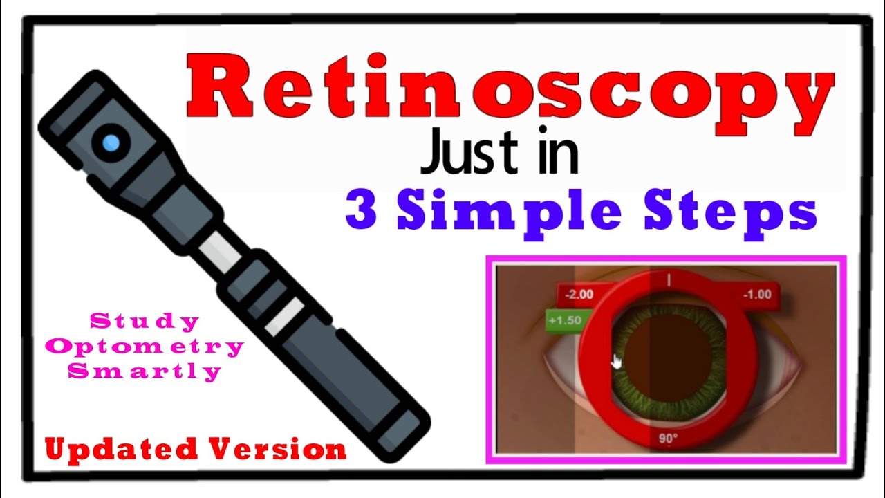 Updated- Retinoscopy just in 3 Simple Steps