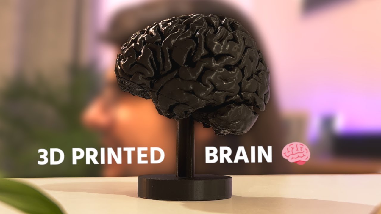 From MRI to 3D Print: My brain in plastic
