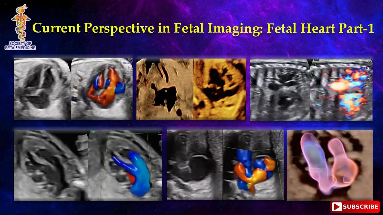 Current Perspective in Fetal Imaging: Fetal Heart Part-1