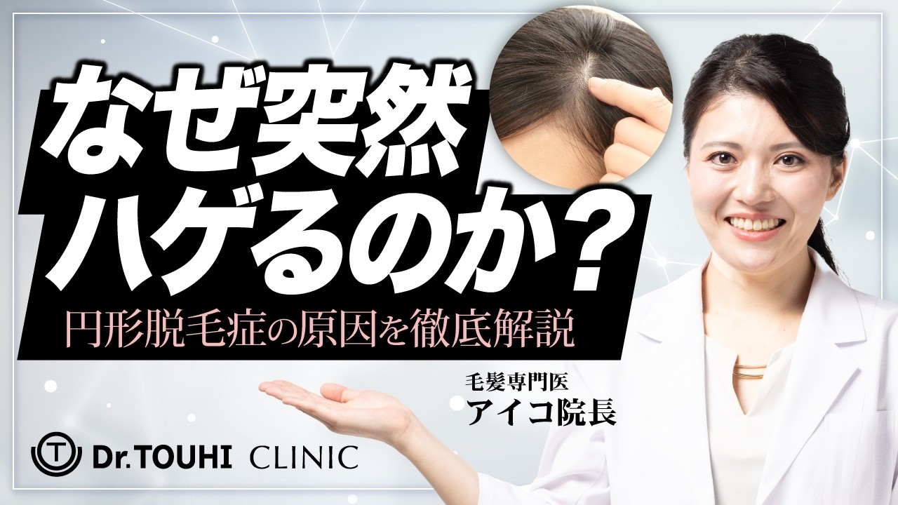 円形脱毛症はなぜ起こる？知られざる原因と最新治療【再生医療】