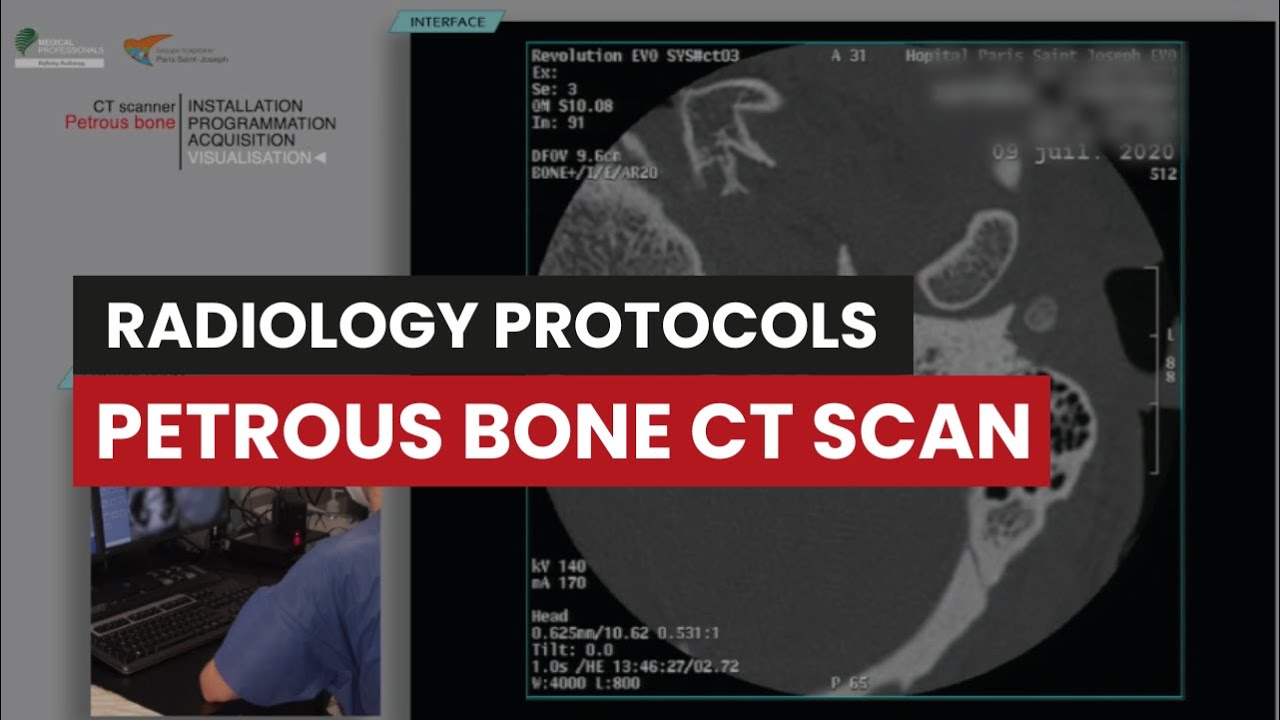 Petrous bone CT Protocol: A  Radiology Techs Video Guide