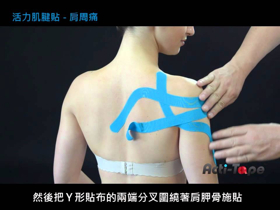 Acti-Tape 活力肌腱貼 - 肩周痛