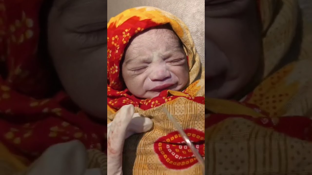  New born baby just after birth/mini blog day 3 to care new born baby 