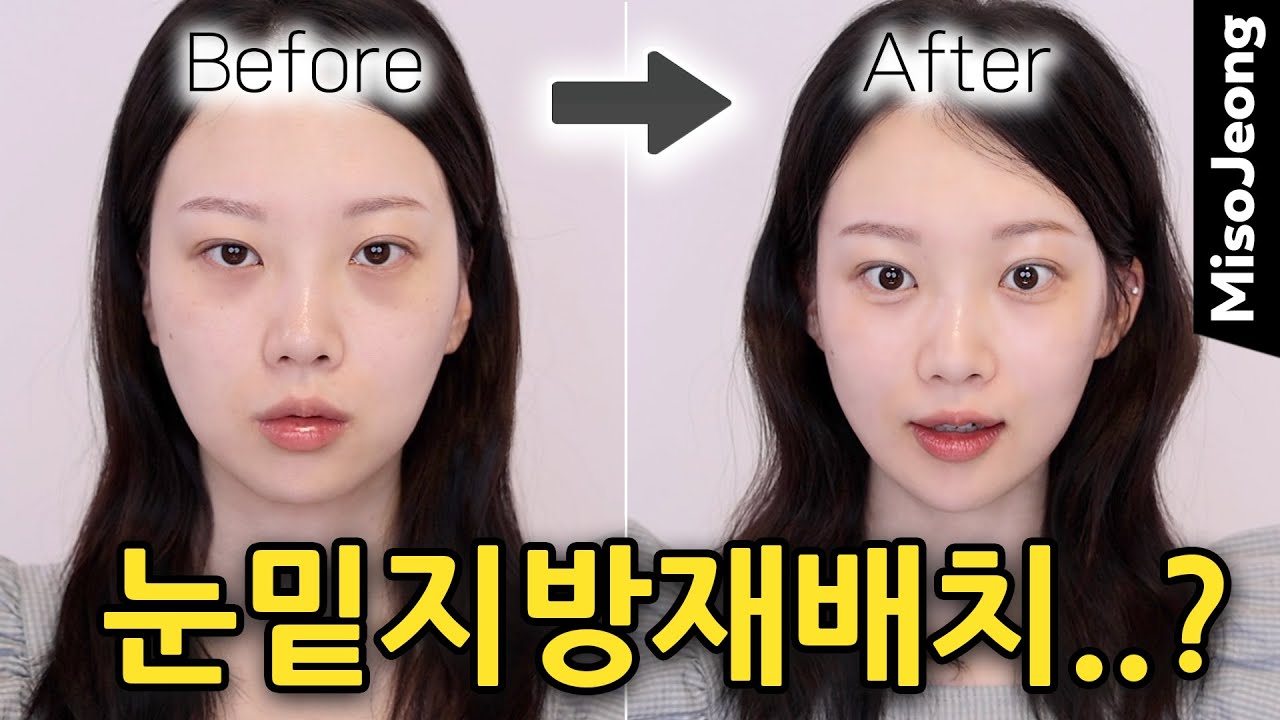 눈 밑 지방 재배치 고민돼 ? 다크서클? 나이 들어 보인다면, 이 루틴 먼저 해봐🔥 [+이벤트🎁]