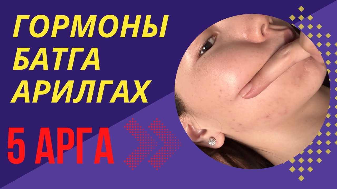 ГОРМОНЫ БАТГА арилгах 5 арга ✨