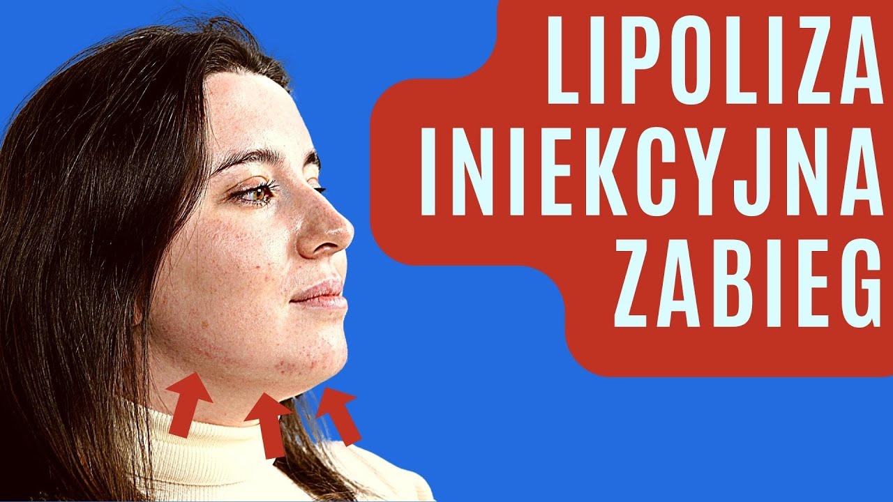 LIPOLIZA Iniekcyjna - Na Czym Polega i czy ROZPUSZCZA TŁUSZCZ? Jak usunąć drugi podbródek-  ZABIEG!