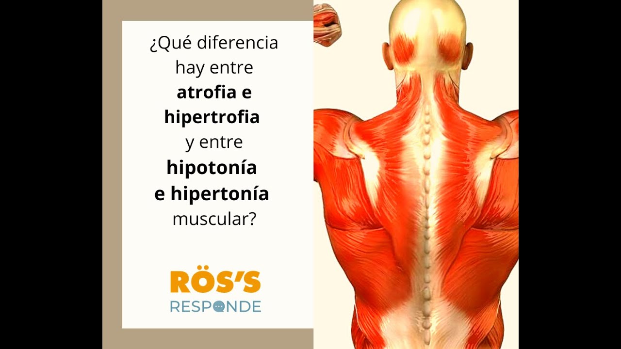 ATROFIA, HIPOTONÍA, HIPERTROFIA, HIPERTONÍA I #ROSSRESPONDE