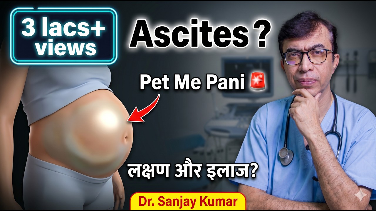 Ascites क्या है ? लक्षण, कारण, और इलाज |  जलोदर (पेट में पानी भरना) - Ascites in Hindi | Gastrocare
