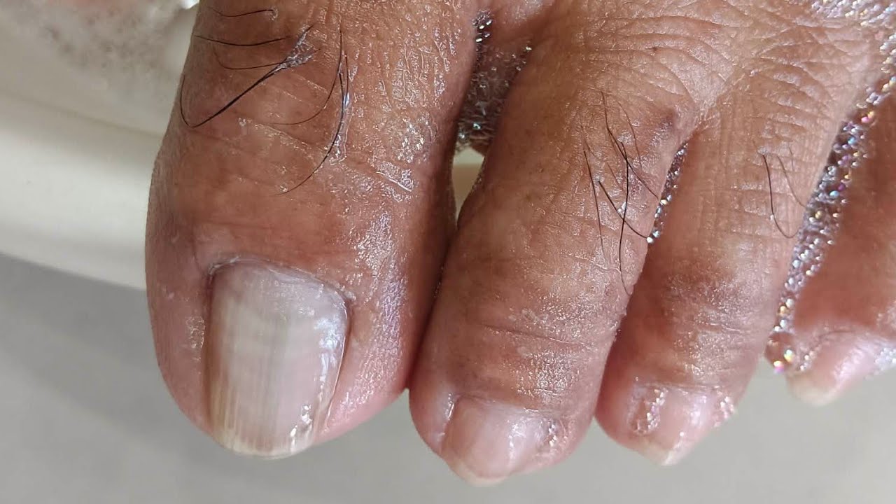 Pedicure Good Job #satisfying Neldz SOLO Parent  is live!
