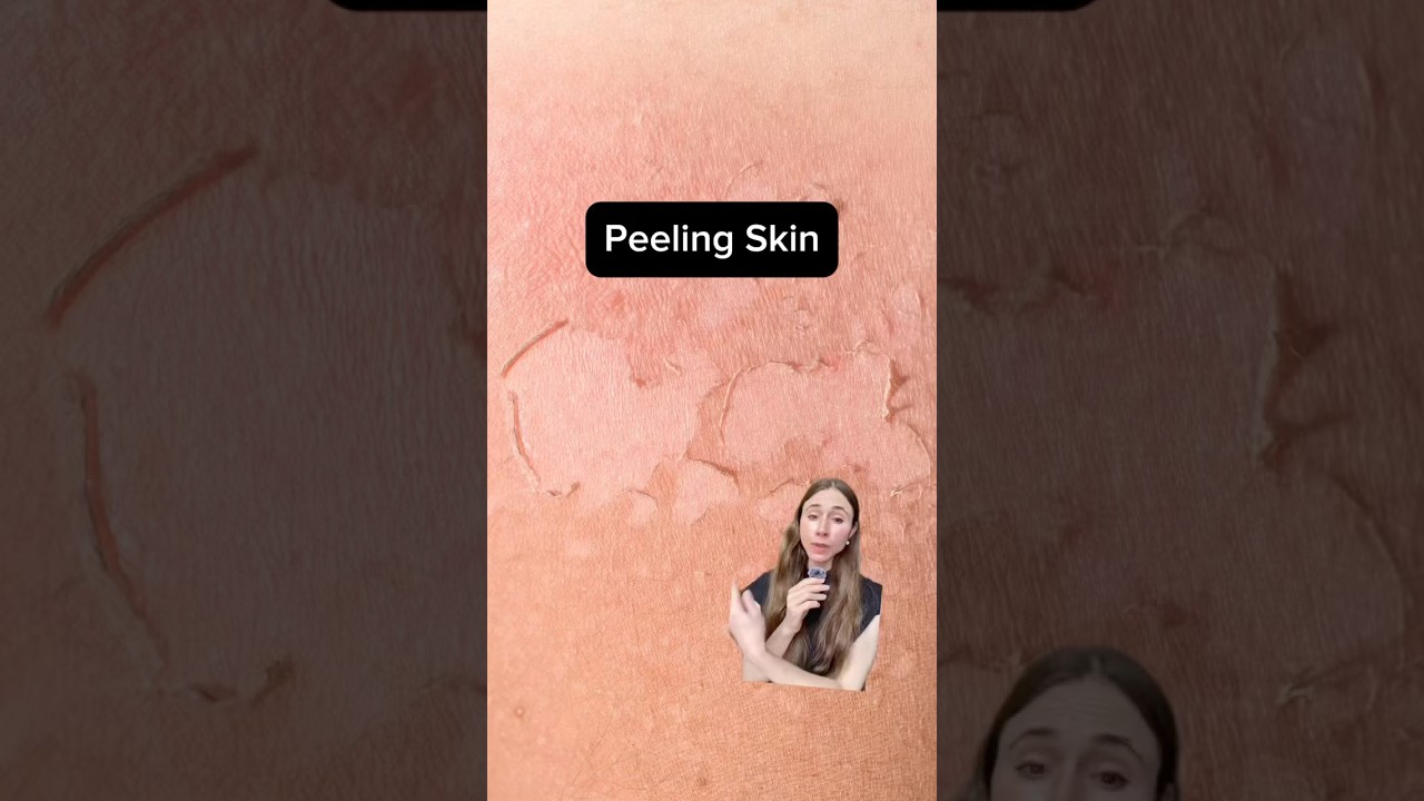 Stop Peeling Skin Fast - Dermatologist's Secret Method