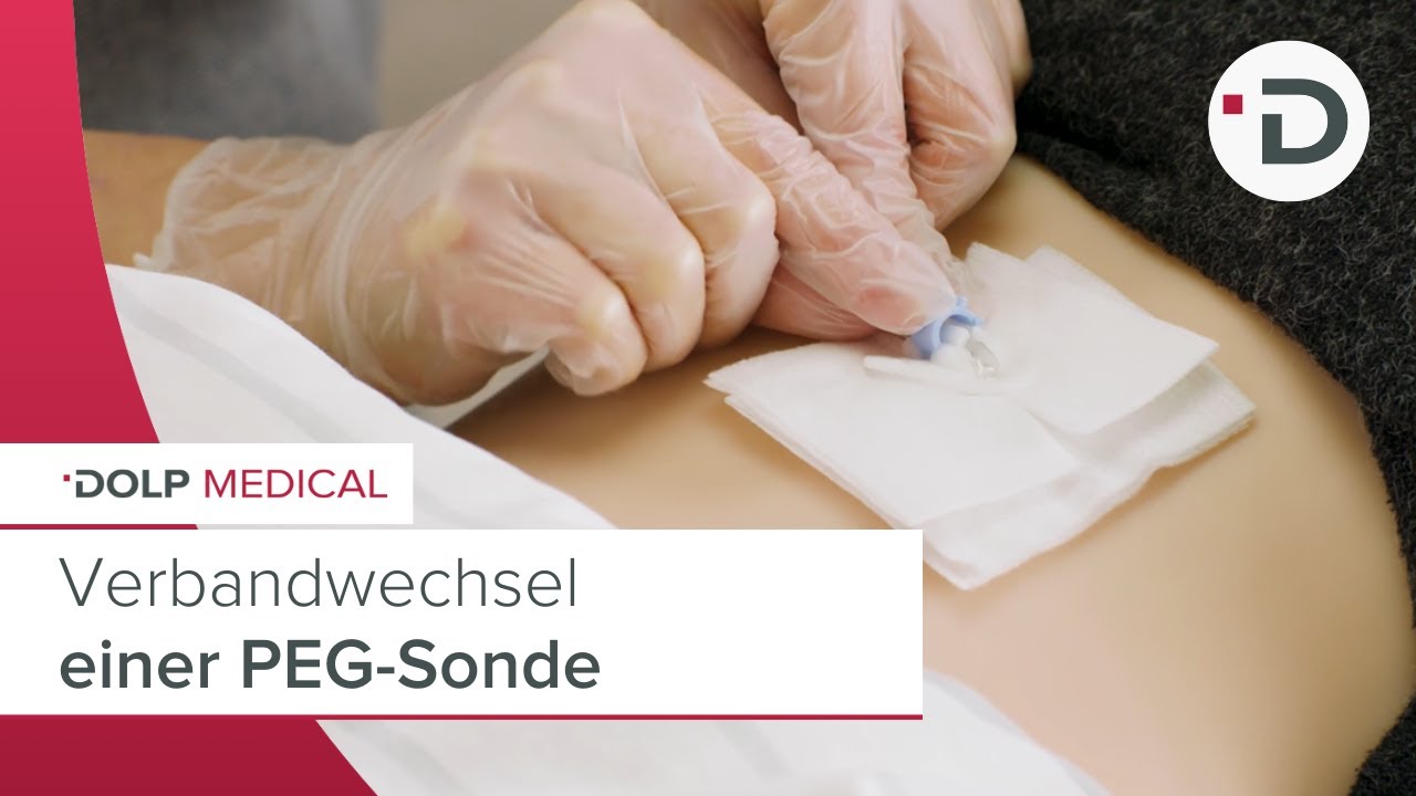 Verbandwechsel PEG / Magensonde: Eine PEG-Sonde richtig verbinden I DOLPEDIA