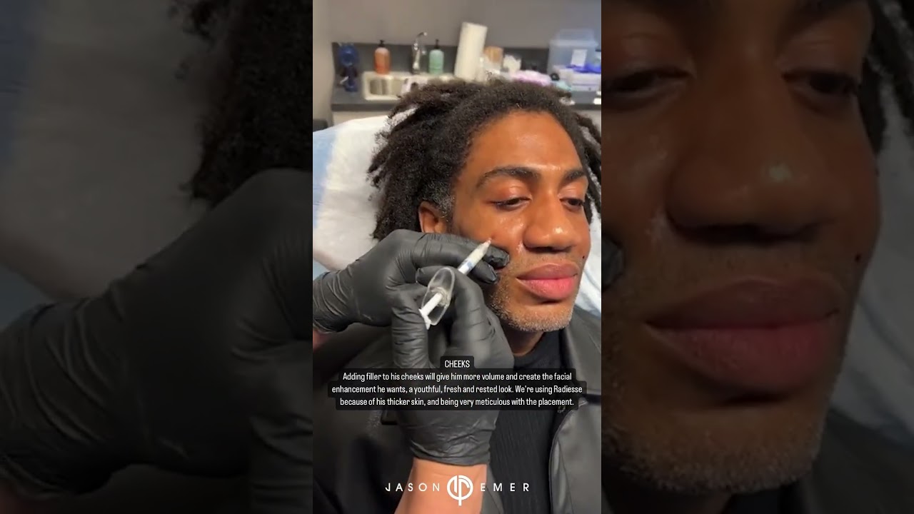 🗿 MALE FACIAL SCULPTING 💉