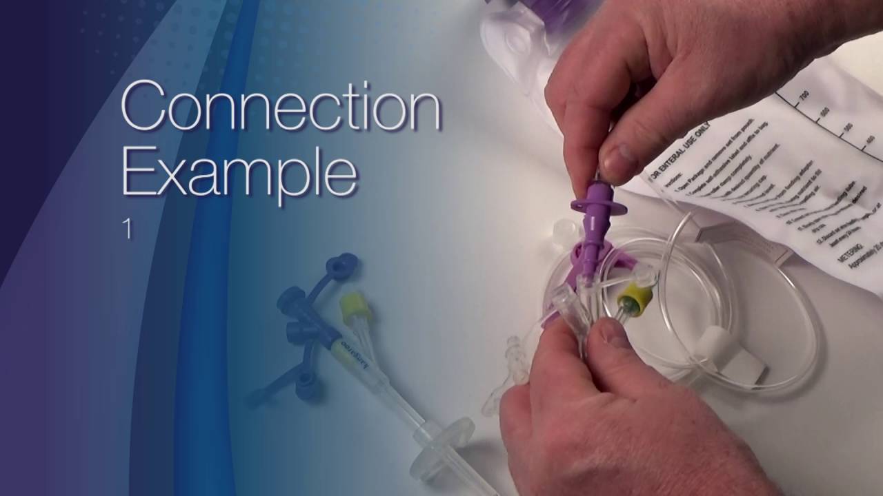 ENFit&trade; Transition Connector Demonstration