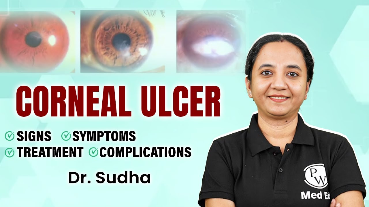 Corneal Ulcer | Ophthalmology | Ophthalmology Simplified with Dr. Sudha | PW MedEd