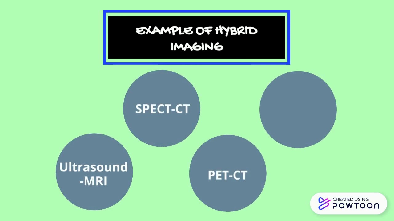 HYBRID IMAGING ASSIGNMENT - PET CT