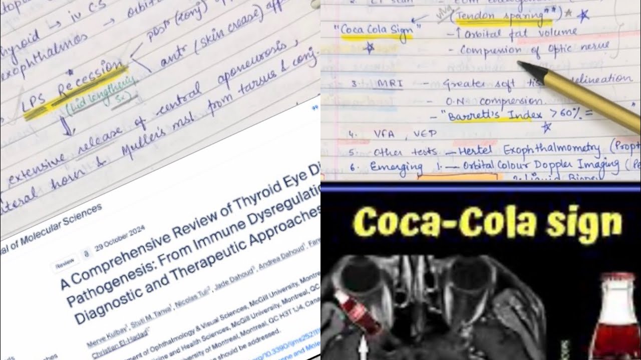Thyroid Eye Disease | How to Write Answers in Exams | Ophthalmology PG | Mohini Notes